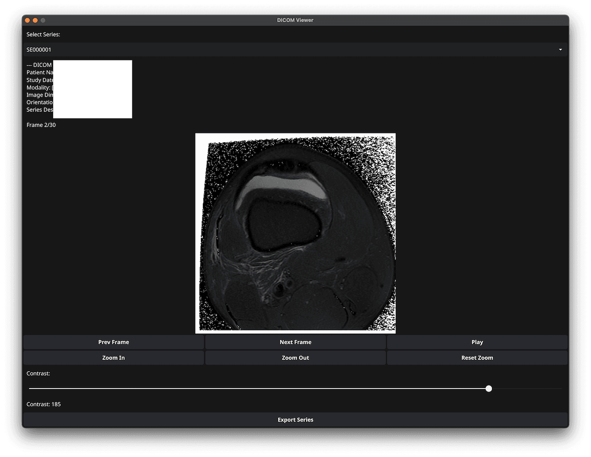 Dicom MRI Viewer